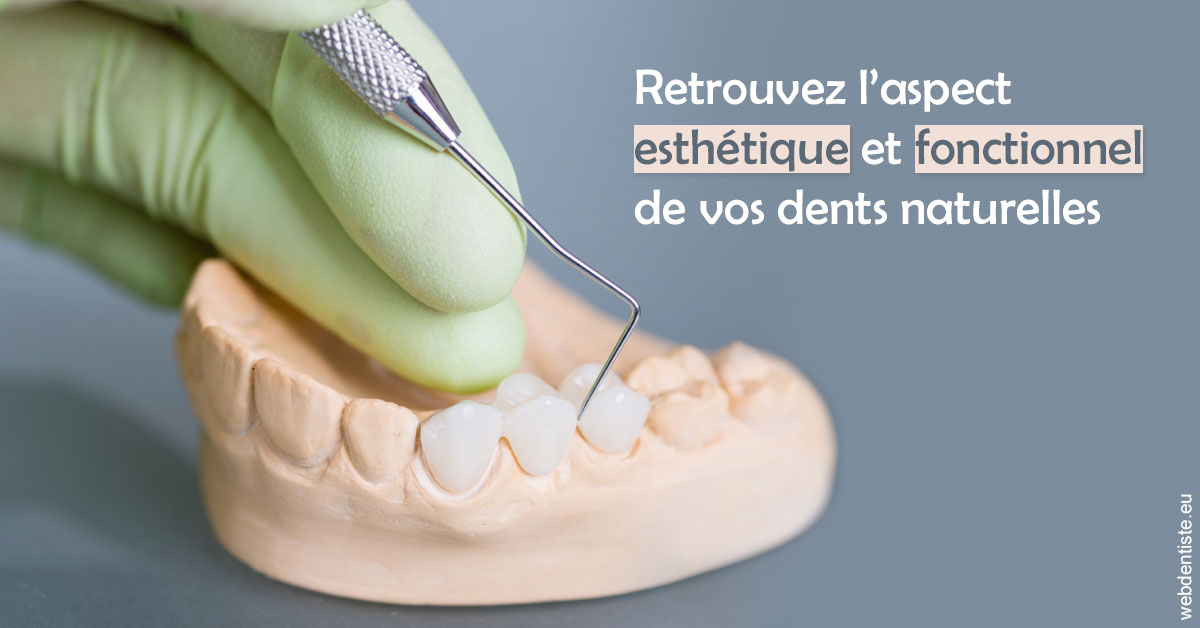 https://dr-anne-laure-pissavin.chirurgiens-dentistes.fr/Restaurations dentaires 1