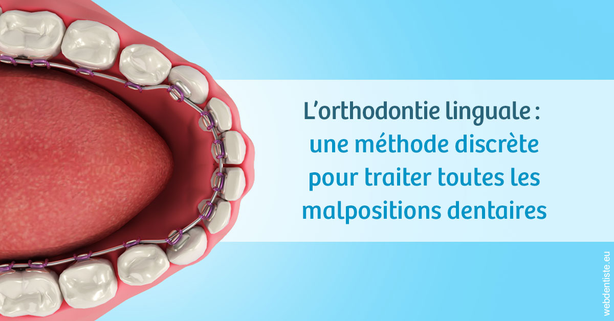 https://dr-anne-laure-pissavin.chirurgiens-dentistes.fr/L'orthodontie linguale 1