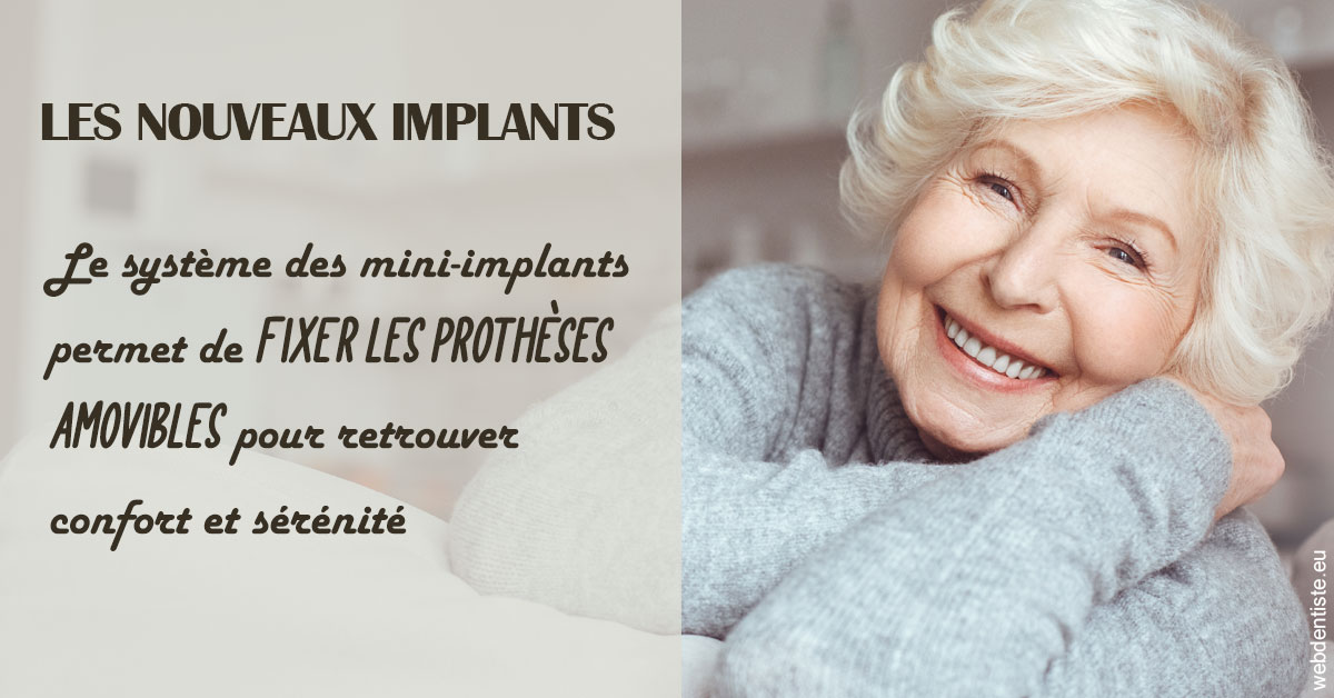 https://dr-anne-laure-pissavin.chirurgiens-dentistes.fr/Les nouveaux implants 1