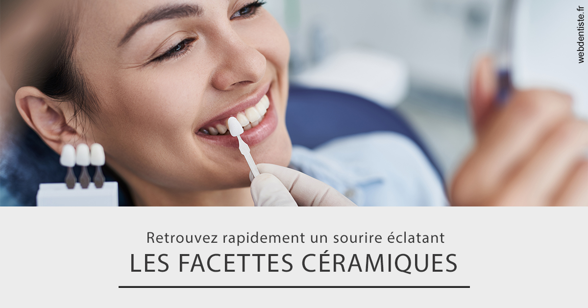 https://dr-anne-laure-pissavin.chirurgiens-dentistes.fr/Les facettes céramiques 2