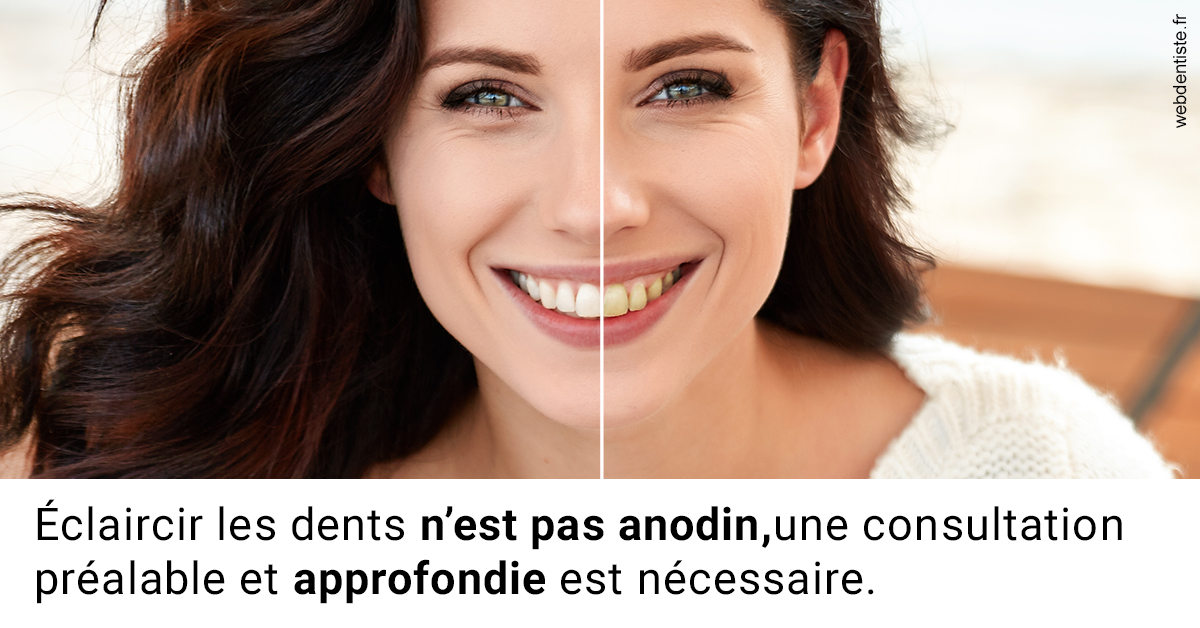 https://dr-anne-laure-pissavin.chirurgiens-dentistes.fr/Le blanchiment 2