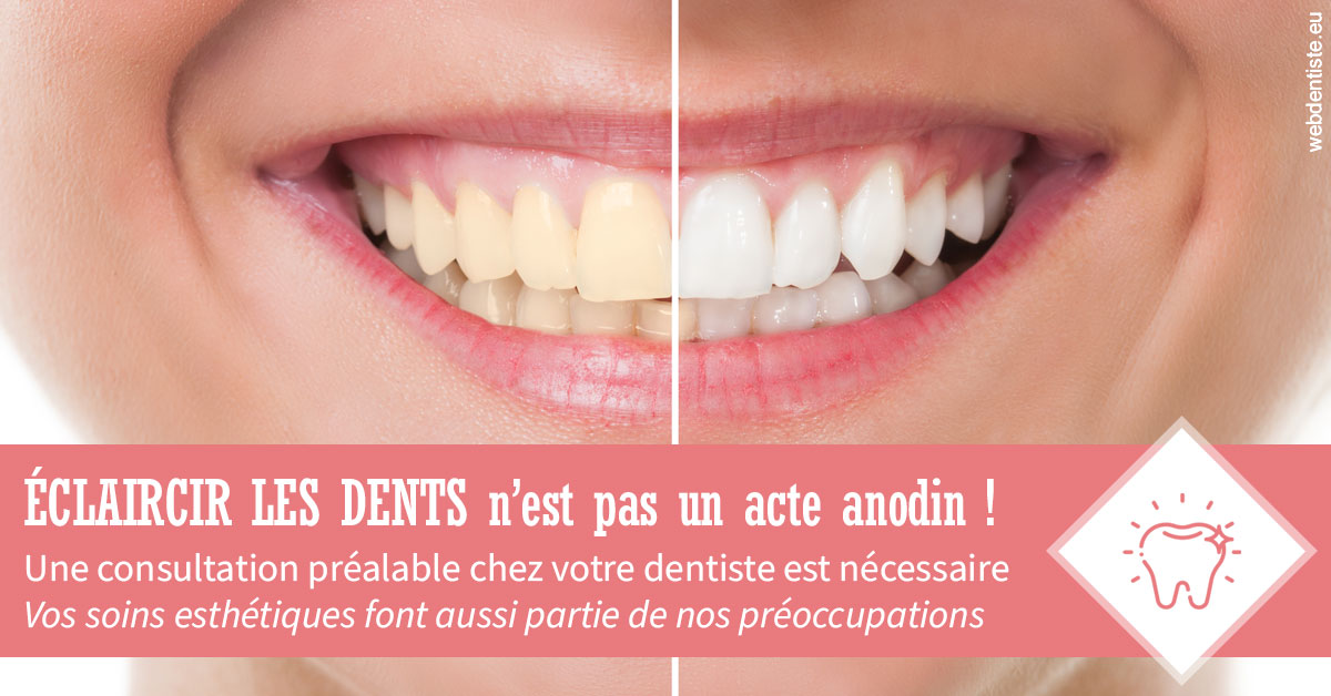 https://dr-anne-laure-pissavin.chirurgiens-dentistes.fr/Eclaircir les dents 1