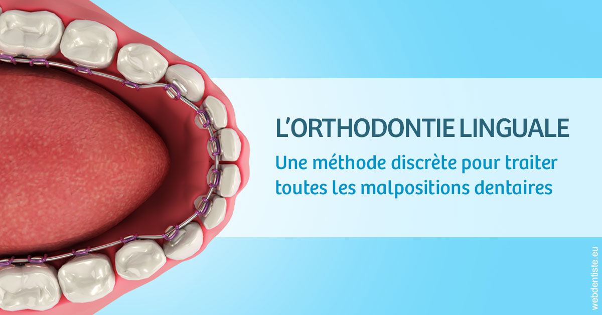 https://dr-anne-laure-pissavin.chirurgiens-dentistes.fr/L'orthodontie linguale 1