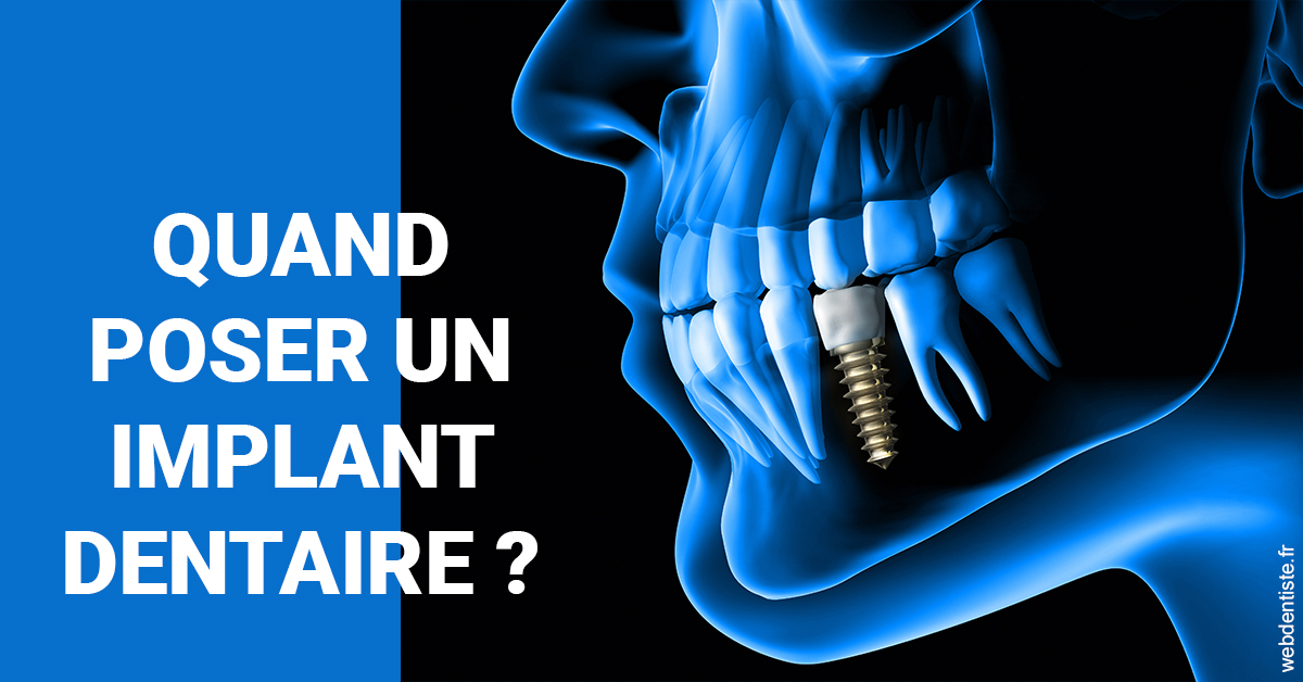 https://dr-anne-laure-pissavin.chirurgiens-dentistes.fr/Les implants 1