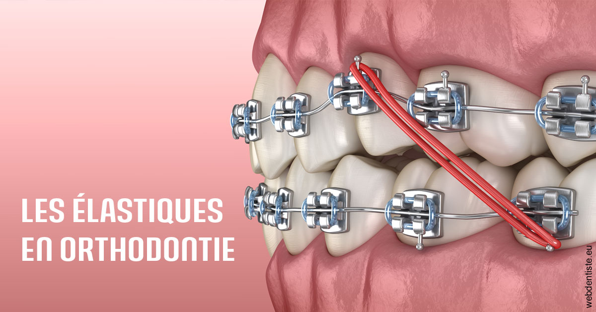 https://dr-anne-laure-pissavin.chirurgiens-dentistes.fr/Elastiques orthodontie 2