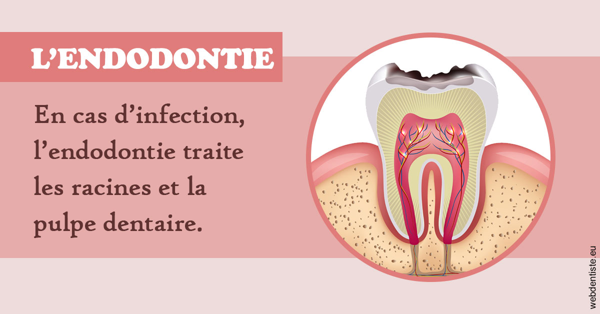 https://dr-anne-laure-pissavin.chirurgiens-dentistes.fr/L'endodontie 2